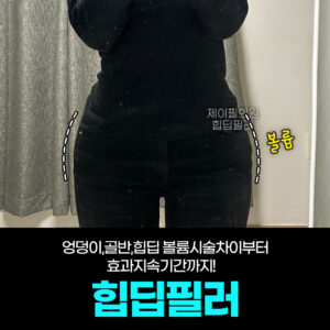 힙딥필러 효과와 유지기간 완벽 정리! 옆엉덩이 꺼짐 해결법