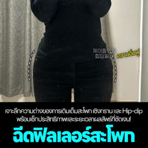 ฉีดฟิลเลอร์สะโพก (Hip Dip Fillers) vs เติมไขมันสะโพก (Fat Grafting) เลือกแบบไหนที่ใช่สำหรับคุณ?