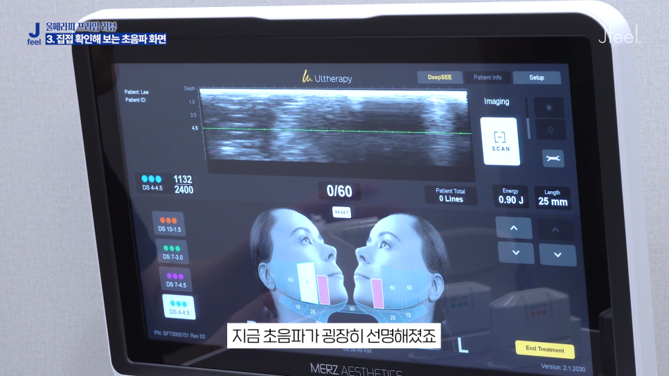 韓國 Jfeel Clinic Ultheraphy Prime 實時超聲波影像監測